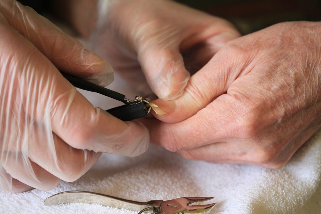 Why We Should Cut Our Nails Regularly? 2023